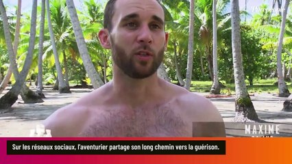 Près de deux mois après la perte de ses doigts, Maxime (Koh-Lanta) partage des photos non censurées