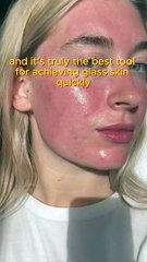 My journey with microneedling!