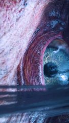 Eclipse of Destiny: Rogue Hero's Fight 🌅