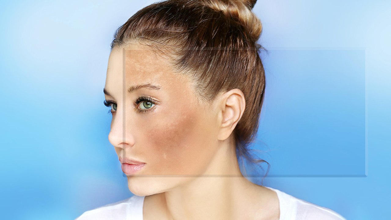 bd-prevenga-las-manchas-en-la-piel-170924