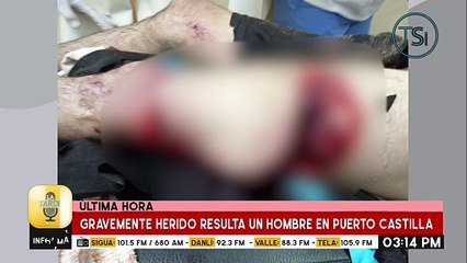 Un hombre resulta gravemente herido en Puerto Castilla, en el Caribe hondureño