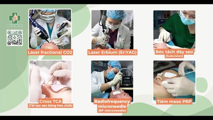 Sẹo rỗ đáy vuông: nguyên nhân và cách điều trị hiệu quả