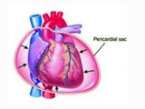 4 types of Pericardial diseases complete information in hindi to prevent heart attack