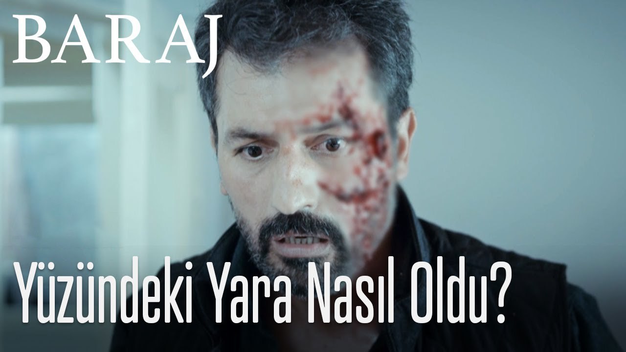 Nazım'ın yüzündeki yara izi nasıl oldu - Baraj