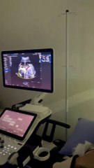 Luan Santana se emociona com ultrassom do 1º filho