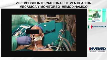 4.- Comprendiendo La Presión Esofágica - Dr. Giacomo Bellani-1.m4v