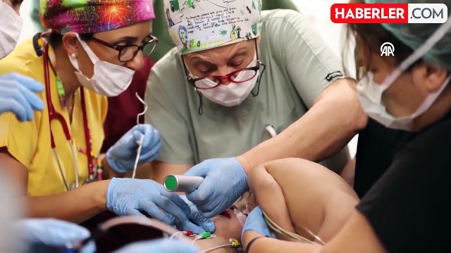 Türkiye'de ilk defa gerçekleştirildi! Pakistanlı başlarından yapışık ikizler ayrıldı