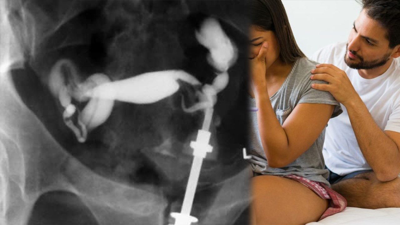 Which Vitamin Deficiency Causes Infertility | Banjhpan Kis Vitamin Ki Kami Se Hota Hai | Boldsky