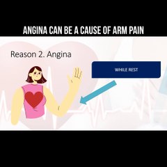 Angina can be a cause of arm pain #angina #armpain