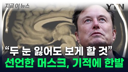 시각장애인에 대혁명...머스크 '야심작' 또 해내나 [지금이뉴스] / YTN
