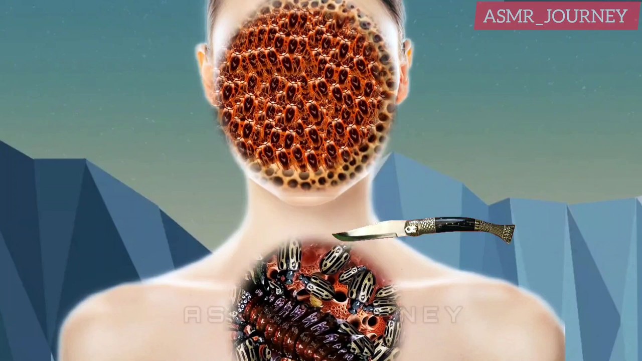 " ASMR INFECTION FACE maggots & Dogtics REMOVAL ANIMATION | ASMR TREATMENT "| #ASMR