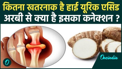 High Uric Acid: इंसान को क्यों होता है हाई यूरिक एसिड, अरबी(Arbi) से क्या नफा-नुकसान? वनइंडिया हिंदी