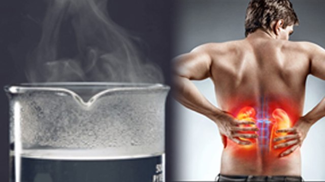 गर्म पानी पीने से Kidney पर क्या असर पड़ता है | Warm Water Side Effects In Kidney Stone | Boldsky