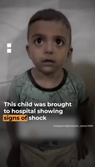 Palestinian child in shock after surviving Israeli attack in Gaza