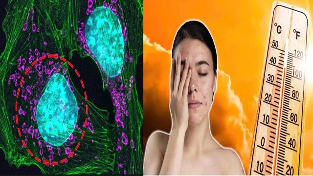 किन लोगों को Skin Cancer का खतरा सबसे ज्यादा | Skin Cancer Risk Factors In Hindi | Boldsky