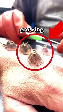 Barnacles Growing On Hand!