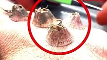 Barnacles Growing On Hand!