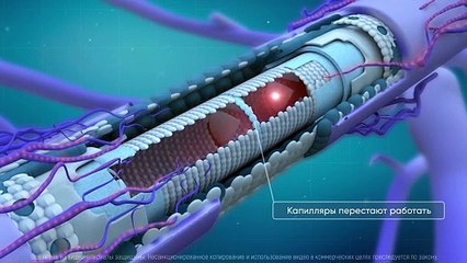 Микросферы и здоровье. Изделия из микросфер для вашего здоровья