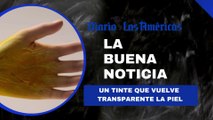 Un tinte que vuelve transparente la piel | La buena noticia