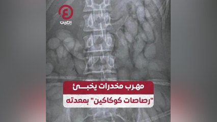 مهرب مخدرات يخبئ "رصاصات كوكاكين" بمعدته