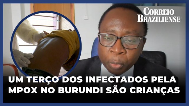 UNICEF alerta: um terço dos infectados pela mpox no Burundi são crianças