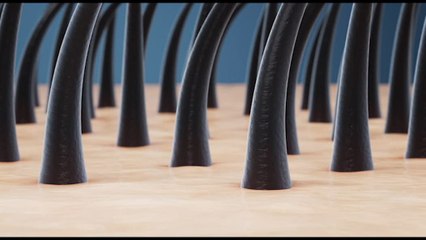 Alopecia Areata, un corso a Milano sulle novità diagnostiche