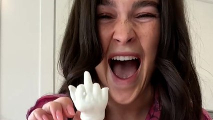 Moment mum opens cast of baby son's hand - to find he's giving her the finger