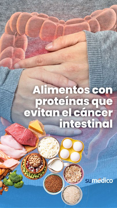 Alimentos con proteínas que evitan el cáncer intestinal
