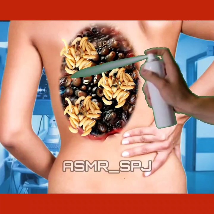 Gentle ASMR BACK BONE Animation ||Healing Backbone Infections"