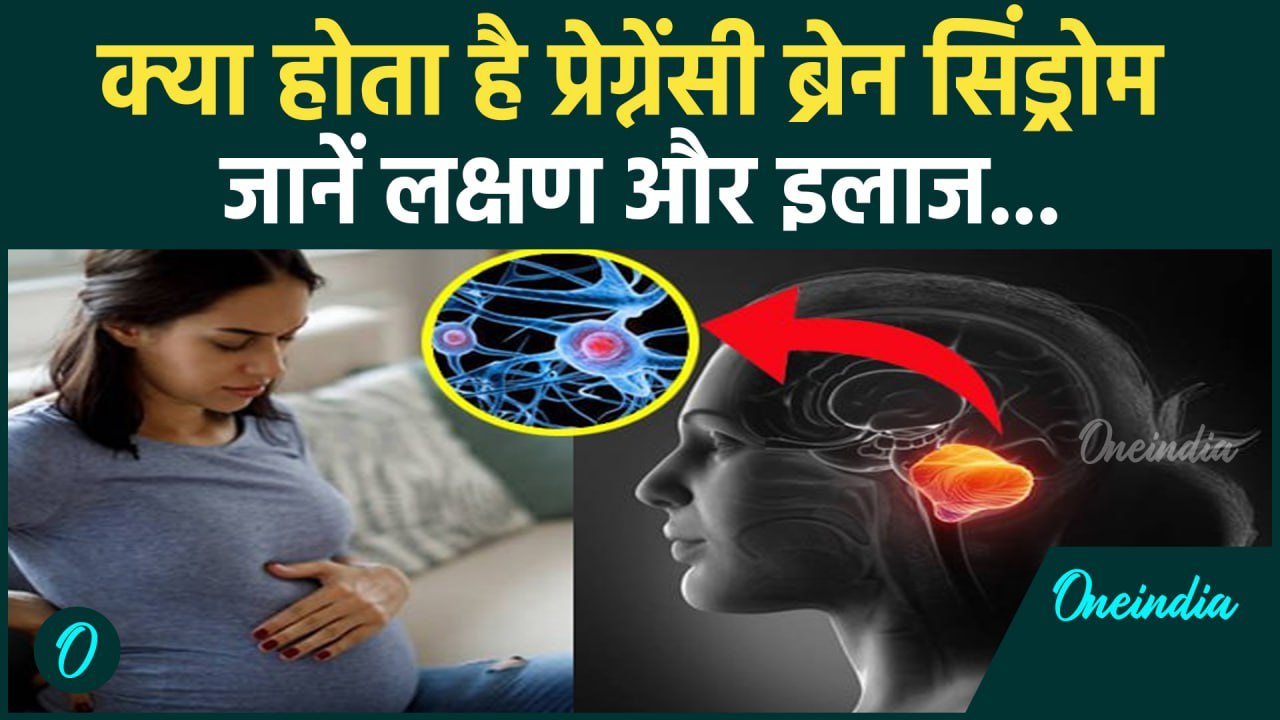Pregnancy Brain क्या होता है | जानें Symptoms and Treatment | वनइंडिया हिंदी