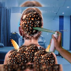 Relaxing Infection Cleaning ASMR | 2D Art Experience"