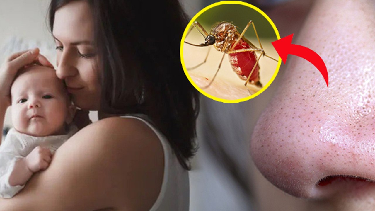 Black Nose Disease Spreading From Pregnant Women To Children, Causes, Symptoms & Treatment...