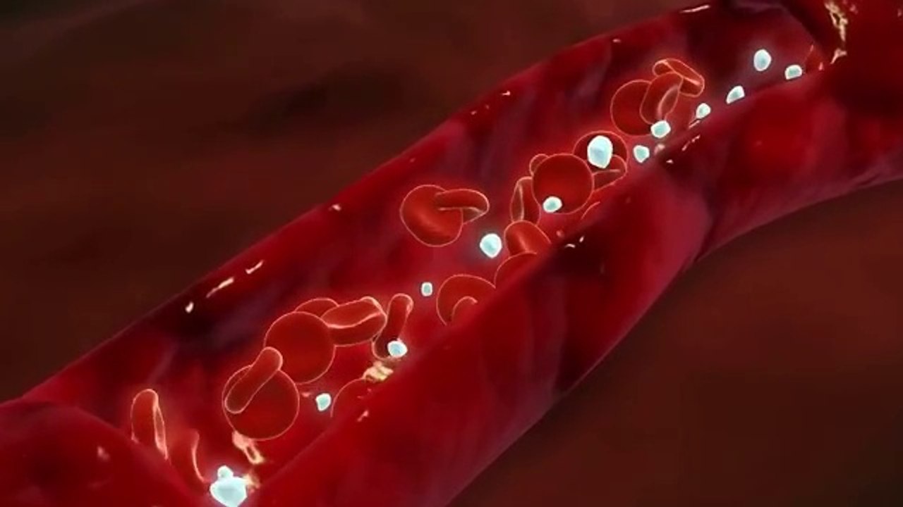 1 Tablespoon a Day...Takes Plaque, Cholesterol, and Pains Away! Dr