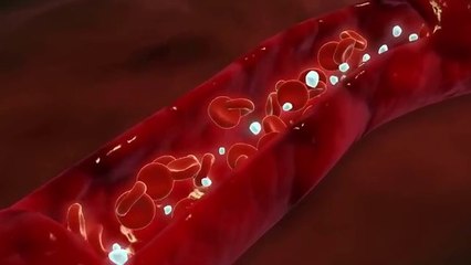 1 Tablespoon a Day...Takes Plaque, Cholesterol, and Pains Away! Dr. Mandell