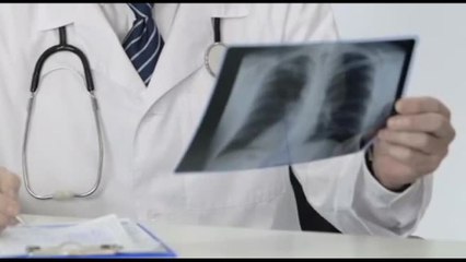 Tumore al polmone: la via maestra è la diagnosi precoce