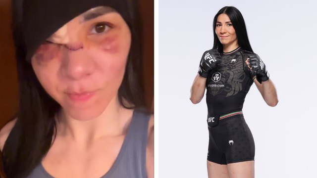 Irene Aldana muestra su rostro a dos semanas del UFC 306