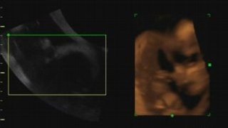 Life in the womb - 4D sonogram of baby eating foot and ...