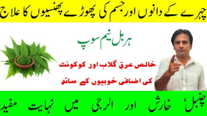 Neem Soap | Herbal Organic Homemade Neem Soap | Pimples And Pigmentation Solution