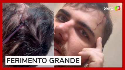 Zé Neto impressiona ao mostrar tamanho de corte na cabeça causado por acidente de quadriciclo em MG