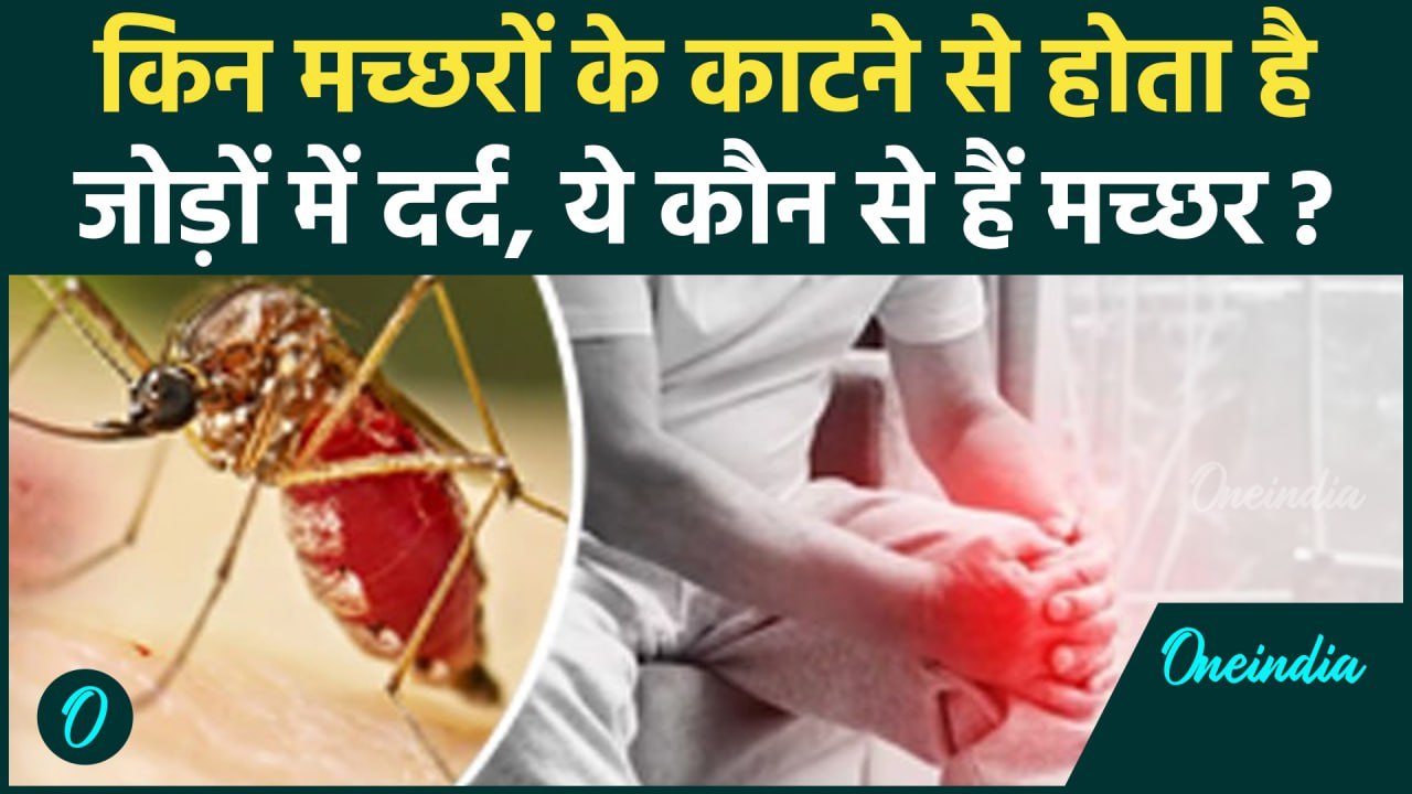 Chikungunya Virus Causes, चिकनगुनिया मच्छरों के काटने के क्या हैं लक्षण, कैसे करें बचाव? वनइंडिया