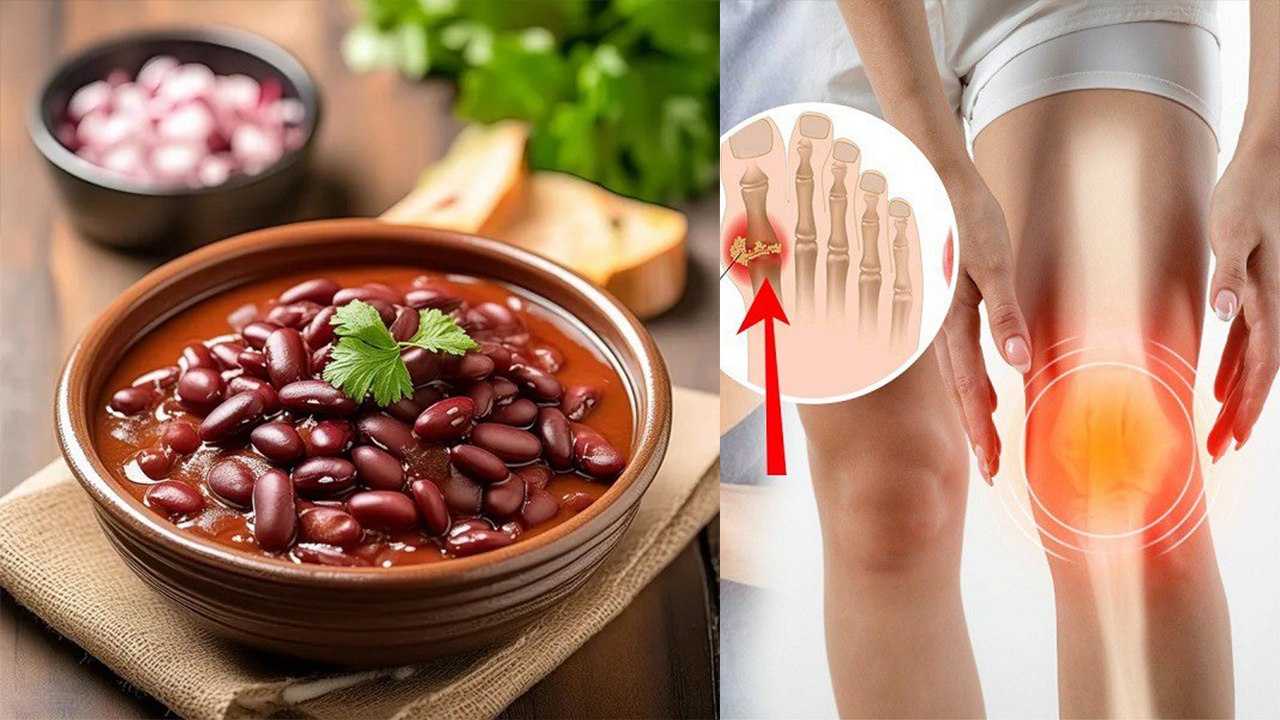 High Uric Acid Me Rajma Khana Chahiye Ya Nahi Red Beans Good For Uric