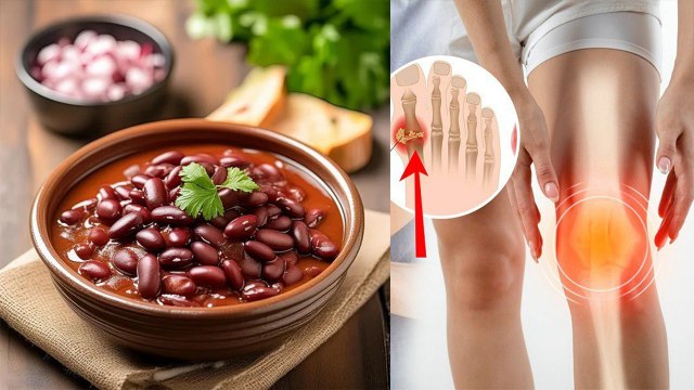 High Uric Acid Me Rajma Khana Chahiye Ya Nahi| Red Beans Good For Uric Acid| Boldsky