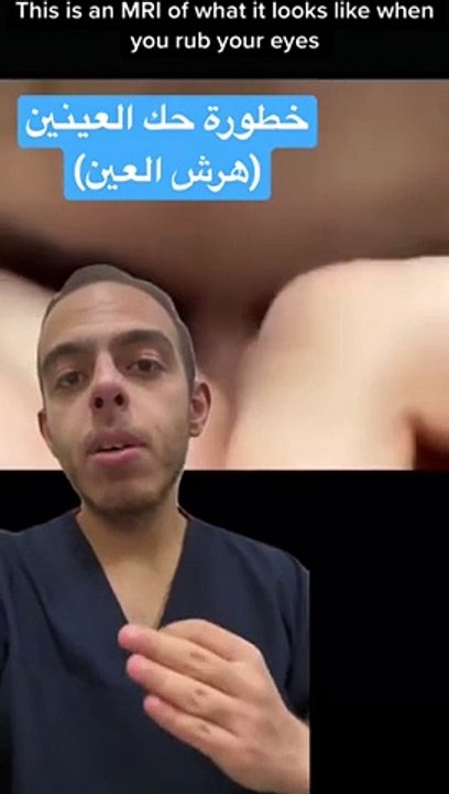 خطورة حك العينين _medicine _طب _shorts(360P)