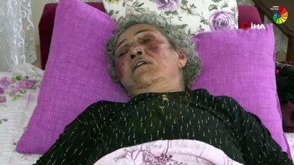 Yok Artık Dedirtti! Yüzük İçin Yaşlı Kadını Öldüresiye Dövdü!