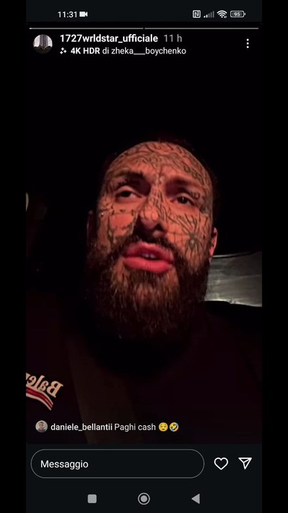 perché siete invidiosi dei miei denti bianchi