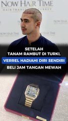 SETELAH TANAM RAMBUT DI TURKI, VERREL HADIAHI DIRI SENDIRI BELI JAM TANGAN MEWAH
