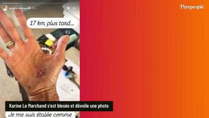Karine Le Marchand blessée à quelques jours d'un grand événement : une photo a été dévoilée, attention les yeux !