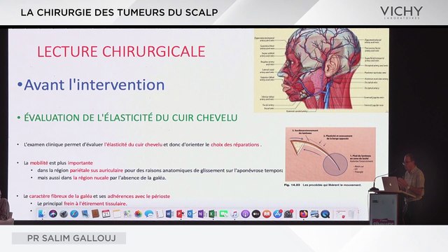 La chirurgie des tumeurs du SCALP par Pr S. GALLOUJ