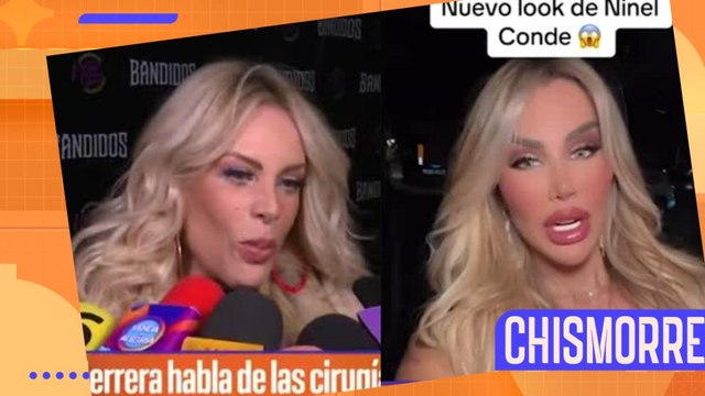 Lorena Herrera confiesa que Ninel Conde pone en riesgo su vida con tantas cirugías
