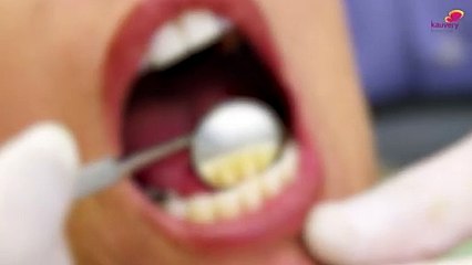 Simple Ways to Fix Bad Breath